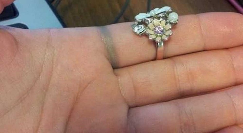 Что означает, если серебро чернеет на теле